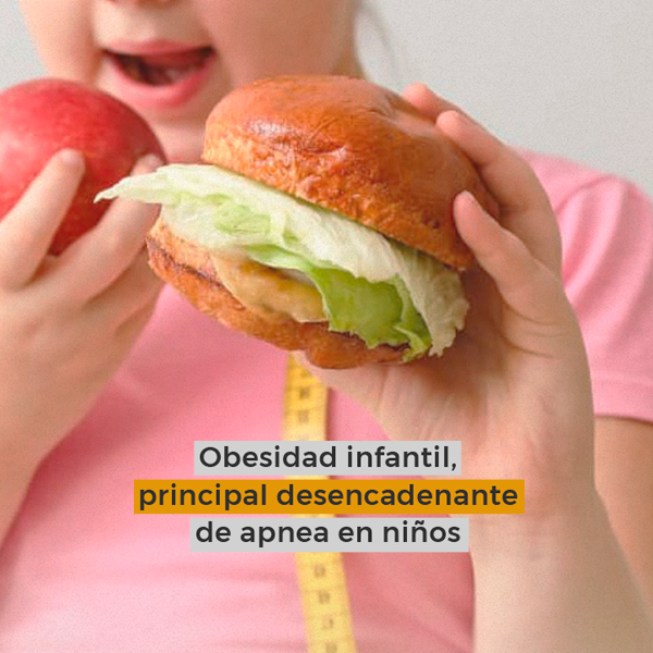 Obesidad infantil, principal desencadenante de apnea en niños